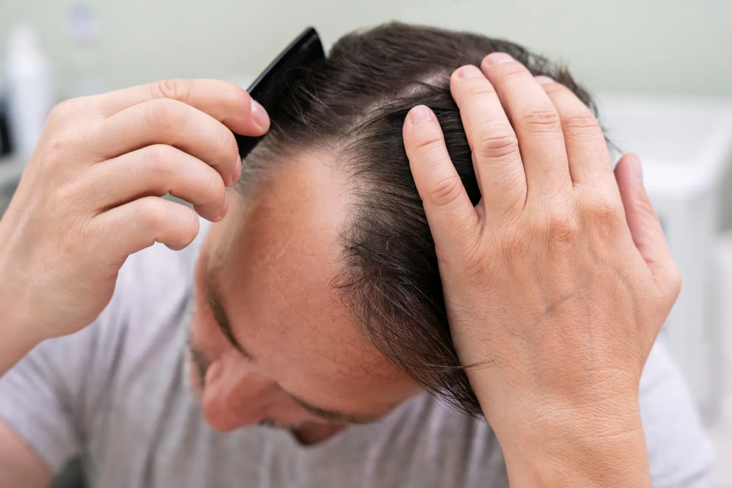 Mature man having balding problems<br />